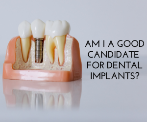 Am I a Good Candidate for Dental Implants?